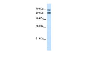 Anti-FAM55D antibody, C-term used in Western blot. GTX46583