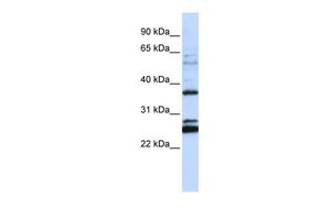 Anti-FAM70A antibody, N-term used in Western blot. GTX46314