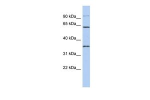 Anti-FAM71B antibody, Internal used in Western blot. GTX45758