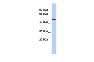 Anti-FAM71D antibody, Internal used in Western blot. GTX47195