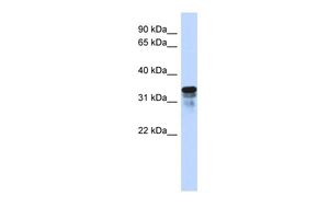 Anti-FAM82B antibody, N-term used in Western blot. GTX46469