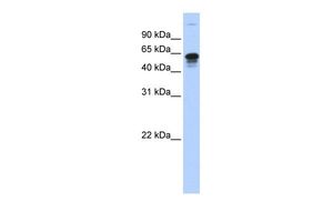 Anti-FAM82C antibody, Internal used in Western blot. GTX46304