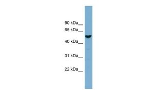 Anti-FAM83E antibody, Internal used in Western blot. GTX44988