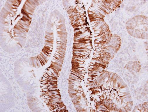 Anti-AHCYL2 antibody [N3C3] used in IHC (Formalin-fixed paraffin-embedded sections). GTX112212