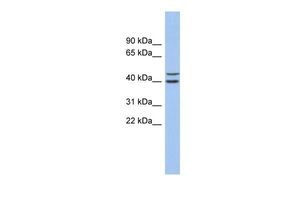 Anti-FBXL14 antibody, N-term used in Western blot. GTX45657