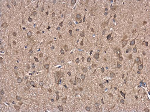 Anti-FBXL16 antibody [N2C3] used in IHC (Formalin-fixed paraffin-embedded sections). GTX120503