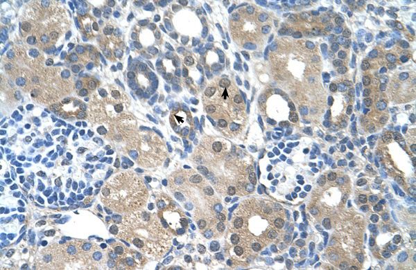 Anti-FBXO25 antibody, C-term used in IHC (Formalin-fixed paraffin-embedded sections). GTX46929