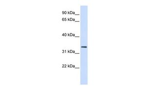 Anti-FBXO25 antibody, N-term used in Western blot. GTX46930