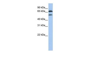 Anti-FBXO7 antibody, Internal used in Western blot. GTX46925