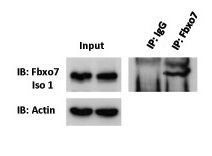 Anti-FBXO7 antibody, Internal used in Immunoprecipitation. GTX46925