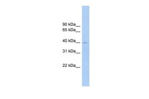 Anti-FCRLM1 antibody, Internal used in Western blot. GTX45923