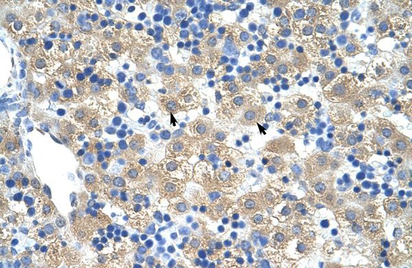 Anti-FERD3L antibody, N-term used in IHC (Formalin-fixed paraffin-embedded sections). GTX48965