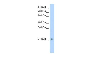 Anti-FERD3L antibody, N-term used in Western blot. GTX48965