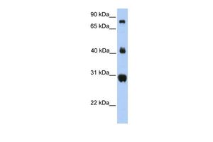 Anti-FIBCD1 antibody, C-term used in Western blot. GTX45919
