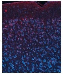 Anti-FIBCD1 antibody, C-term used in IHC (Formalin-fixed paraffin-embedded sections). GTX45919