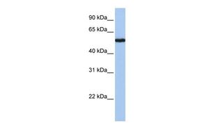 Anti-FLJ90709 antibody, Internal used in Western blot. GTX45575