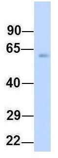 Anti-FMO4 antibody, N-term used in Western blot. GTX46568
