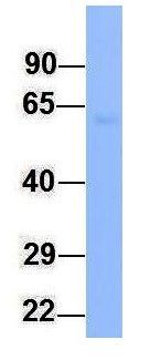 Anti-FMO4 antibody, N-term used in Western blot. GTX46568