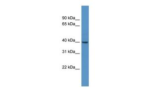 Anti-FOXS1 antibody, N-term used in Western blot. GTX48944