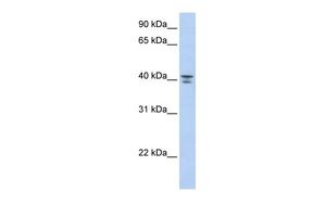 Anti-G protein alpha 12 antibody, Internal used in Western blot. GTX45376
