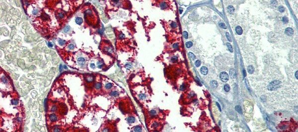 Anti-G6PC antibody, N-term used in IHC (Formalin-fixed paraffin-embedded sections). GTX46748
