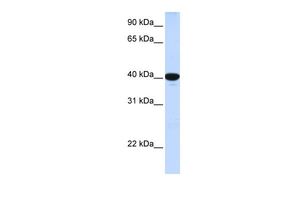 Anti-G6PC antibody, N-term used in Western blot. GTX46748