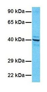 Anti-G6PC antibody, N-term used in Western blot. GTX46748