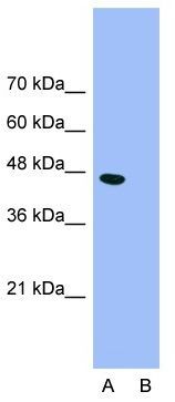 Anti-GABA A Receptor pi antibody, N-term used in Western blot. GTX77697