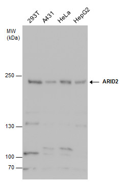 Anti-ARID2 antibody used in Western blot. GTX129443