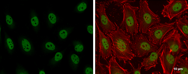 Anti-ARID2 antibody used in Immunocytochemistry/ Immunofluorescence. GTX129443