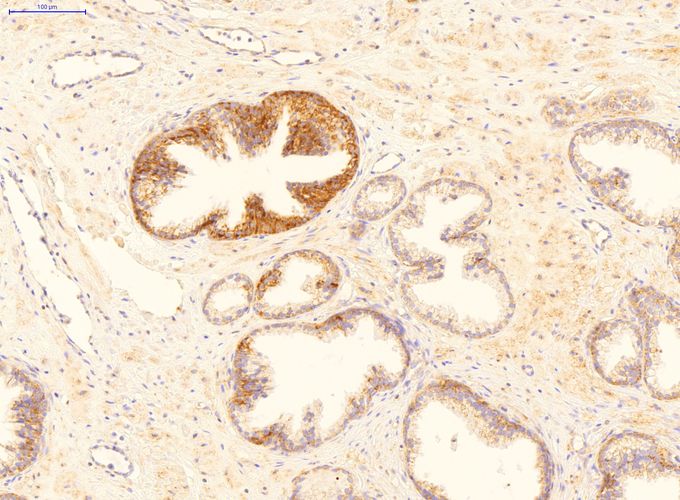 Anti-GADD45B antibody, Internal used in IHC (Formalin-fixed paraffin-embedded sections). GTX46244