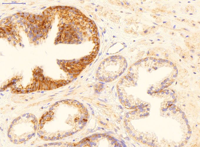 Anti-GADD45B antibody, Internal used in IHC (Formalin-fixed paraffin-embedded sections). GTX46244