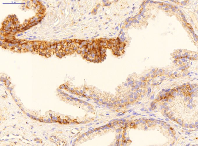 Anti-GADD45B antibody, Internal used in IHC (Formalin-fixed paraffin-embedded sections). GTX46244