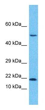 Anti-GADD45B antibody, Internal used in Western blot. GTX46244