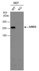 Anti-ARID2 antibody [GT7311] used in Western blot. GTX632011