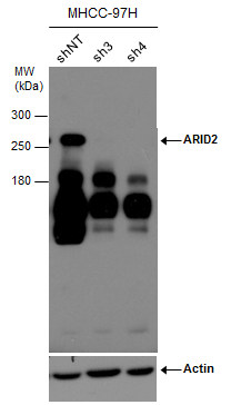 Anti-ARID2 antibody [GT7311] used in Western blot. GTX632011