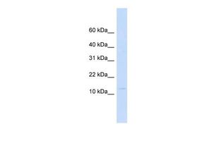 Anti-Galectin-13 antibody, N-term used in Western blot. GTX49089