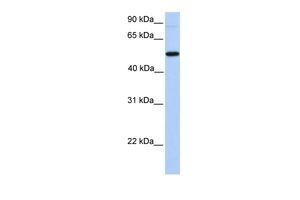 Anti-GALNT13 antibody, N-term used in Western blot. GTX16278