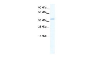 Anti-GATA5 antibody, C-term used in Western blot. GTX48976