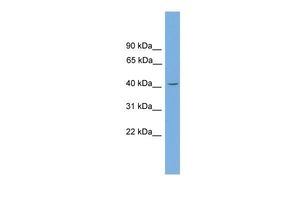 Anti-GATA5 antibody, N-term used in Western blot. GTX48995