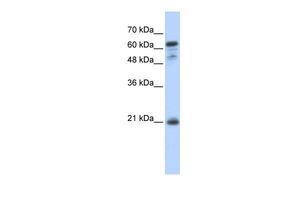 Anti-GCET2 antibody, Internal used in Western blot. GTX45254