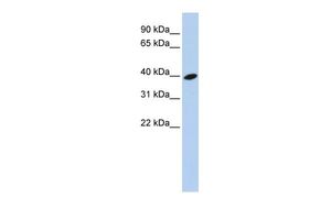 Anti-ARL13B antibody, Internal used in Western blot. GTX45702