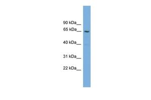 Anti-GGT2 antibody, N-term used in Western blot. GTX49028