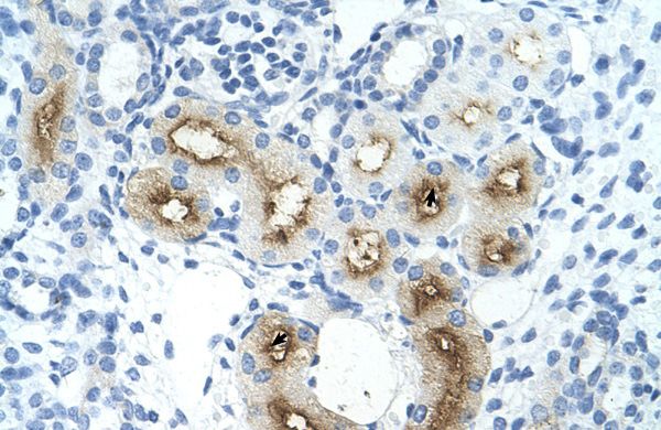 Anti-GGTLA4 antibody, C-term used in IHC (Formalin-fixed paraffin-embedded sections). GTX47132