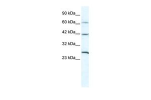 Anti-GJC1 antibody, N-term used in Western blot. GTX47480
