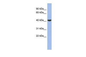 Anti-GJD4 antibody, Internal used in Western blot. GTX47477