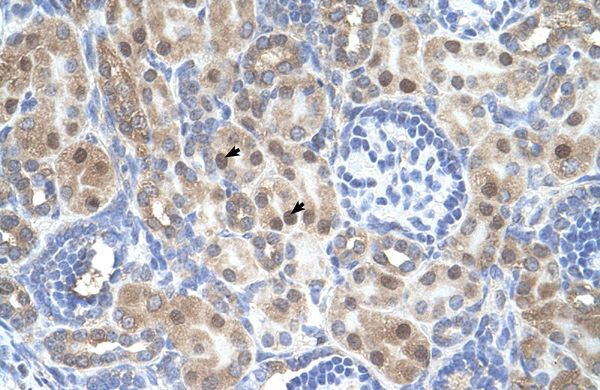 Anti-ARMCX6 antibody, N-term used in IHC (Formalin-fixed paraffin-embedded sections). GTX46680