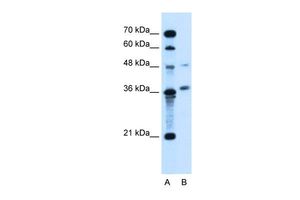 Anti-ARMCX6 antibody, N-term used in Western blot. GTX46680