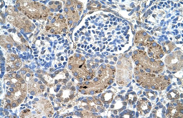 Anti-GLS2 antibody, Internal used in IHC (Formalin-fixed paraffin-embedded sections). GTX46870
