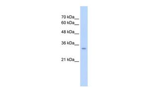 Anti-GLS2 antibody, Internal used in Western blot. GTX46870